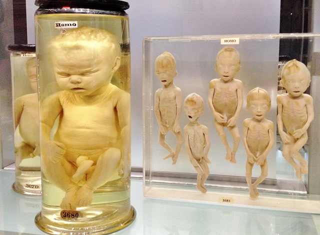 Curiosities